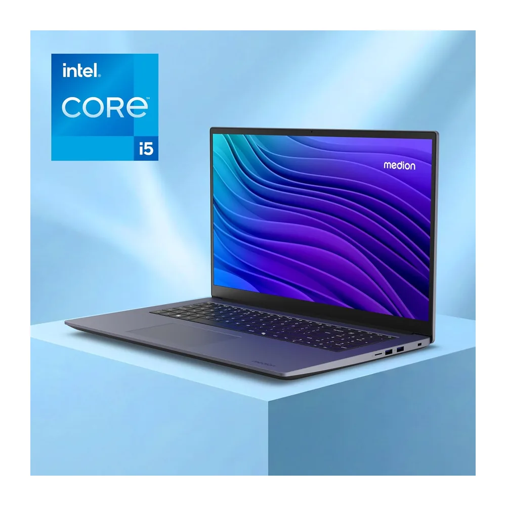 MEDION Avantum 17 E1i 43,9 cm (17,3 Zoll) Full HD Laptop — 2
